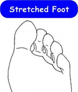 4_STRETCHED FOOT